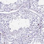 ESX1 Antibody in Immunohistochemistry (Paraffin) (IHC (P))