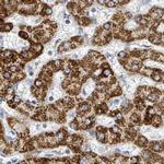 SUCLG2 Antibody in Immunohistochemistry (IHC)