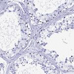 LUZP4 Antibody in Immunohistochemistry (IHC)