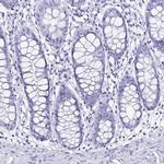 LUZP4 Antibody in Immunohistochemistry (IHC)