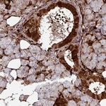 SLC5A10 Polyclonal Antibody