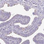 PNLDC1 Antibody in Immunohistochemistry (IHC)