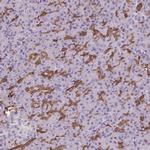 PNLDC1 Antibody in Immunohistochemistry (IHC)