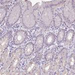 PNLDC1 Antibody in Immunohistochemistry (IHC)