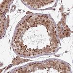 SWI5 Antibody in Immunohistochemistry (IHC)