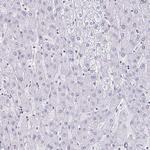 DAB1 Antibody in Immunohistochemistry (Paraffin) (IHC (P))
