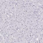 DAB1 Antibody in Immunohistochemistry (IHC)