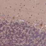 KCTD11 Antibody in Immunohistochemistry (Paraffin) (IHC (P))