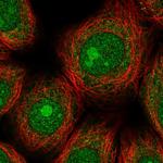 ZNF354A Polyclonal Antibody