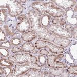 ZNF354A Antibody in Immunohistochemistry (Paraffin) (IHC (P))
