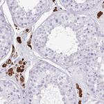 SLC35G2 Antibody in Immunohistochemistry (Paraffin) (IHC (P))