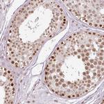 ZNF778 Antibody in Immunohistochemistry (IHC)