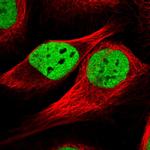 TAF15 Polyclonal Antibody