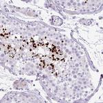 ZNF568 Polyclonal Antibody