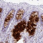 ZG16 Polyclonal Antibody