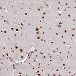 U2AF1 Polyclonal Antibody