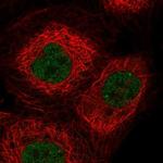 OGFOD3 Polyclonal Antibody