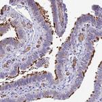 TTC30A Polyclonal Antibody