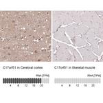 C17orf51 Antibody in Immunohistochemistry (IHC)