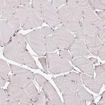 C17orf51 Antibody in Immunohistochemistry (IHC)