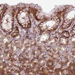 MROH2A Polyclonal Antibody