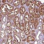 PNMA6A Polyclonal Antibody