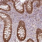 TMEM8B Polyclonal Antibody