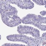 Factor XIII B Antibody in Immunohistochemistry (Paraffin) (IHC (P))