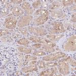 Factor XIII B Antibody in Immunohistochemistry (Paraffin) (IHC (P))