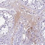 Factor XIII B Antibody in Immunohistochemistry (Paraffin) (IHC (P))