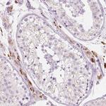 ZNF639 Polyclonal Antibody