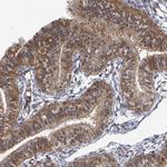 C7orf26 Polyclonal Antibody