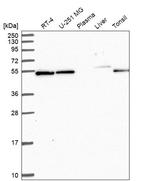 C7orf26 Antibody in Western Blot (WB)