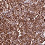 WBSCR22 Antibody in Immunohistochemistry (Paraffin) (IHC (P))