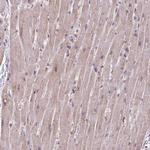 RPP25L Antibody in Immunohistochemistry (Paraffin) (IHC (P))