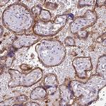 RPP25L Antibody in Immunohistochemistry (Paraffin) (IHC (P))