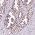 RPP25L Antibody in Immunohistochemistry (Paraffin) (IHC (P))