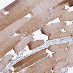 RPP25L Antibody in Immunohistochemistry (Paraffin) (IHC (P))