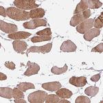 KBTBD5 Polyclonal Antibody