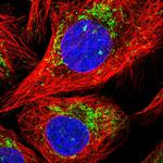 MALSU1 Polyclonal Antibody