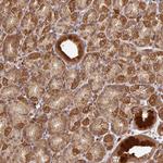 MALSU1 Antibody in Immunohistochemistry (Paraffin) (IHC (P))