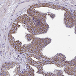CSDE1 Antibody in Immunohistochemistry (IHC)