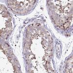 CSDE1 Antibody in Immunohistochemistry (IHC)