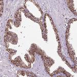 LRRC24 Polyclonal Antibody