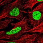 C1orf226 Polyclonal Antibody