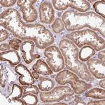 TIMM10B Polyclonal Antibody