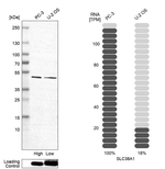 SLC38A1 Antibody in Western Blot (WB)