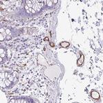 BTD Polyclonal Antibody