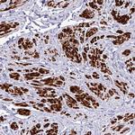 RIPPLY1 Polyclonal Antibody