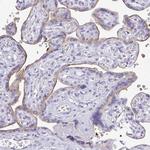 LPPR3 Polyclonal Antibody